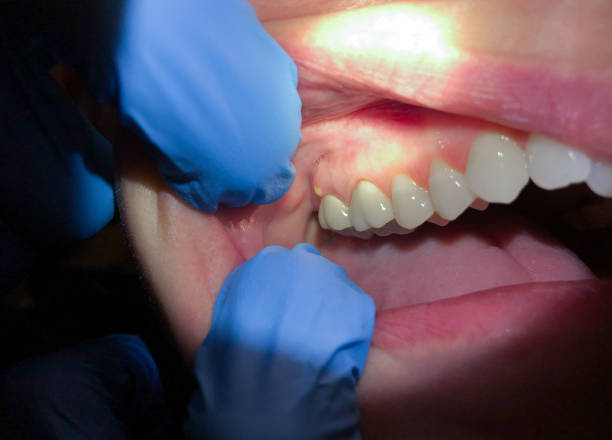 Best Emergency Dental Surgery in Decatur, MI