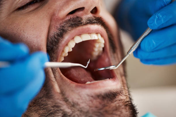 Best After-Hours Emergency Dentist in Decatur, MI