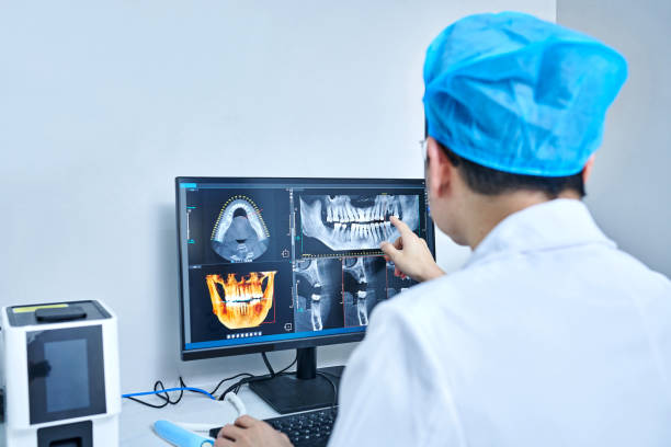 Best Emergency Tooth Extraction in Decatur, MI