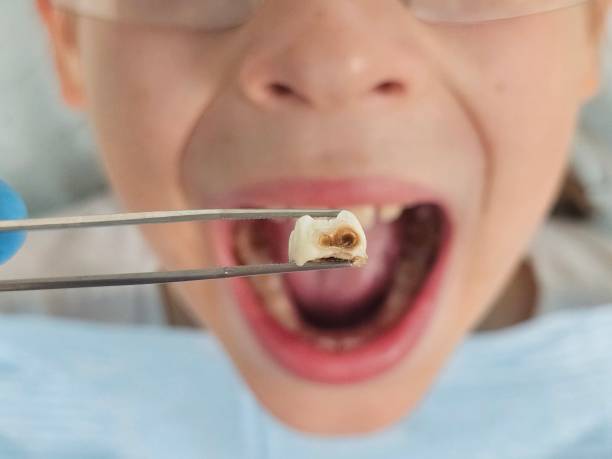 Best Emergency Orthodontic Repairs in Decatur, MI