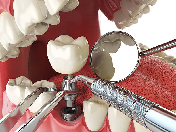 Best Emergency Dental Care for Trauma or Injury in Decatur, MI
